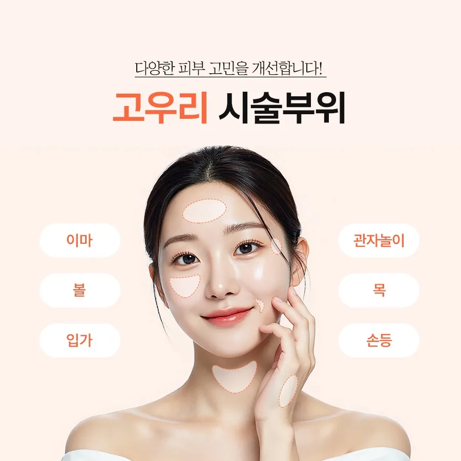다미온의원 고우리 — 시술 부위