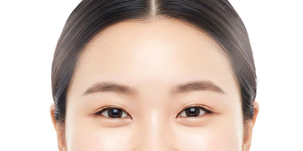 다미온의원 눈매교정 안내 이미지 — 모델 두 눈 정면