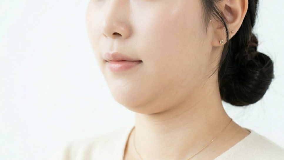 다미온의원 미니리프팅 안내 이미지 — 모델 턱선·목 옆모습